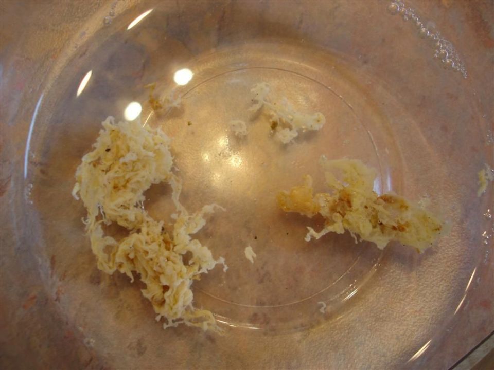 The person who took this picture identified this stool material as Candida. The person used an apple cider vinegar enema to flush this stringy material out of their large intestine.