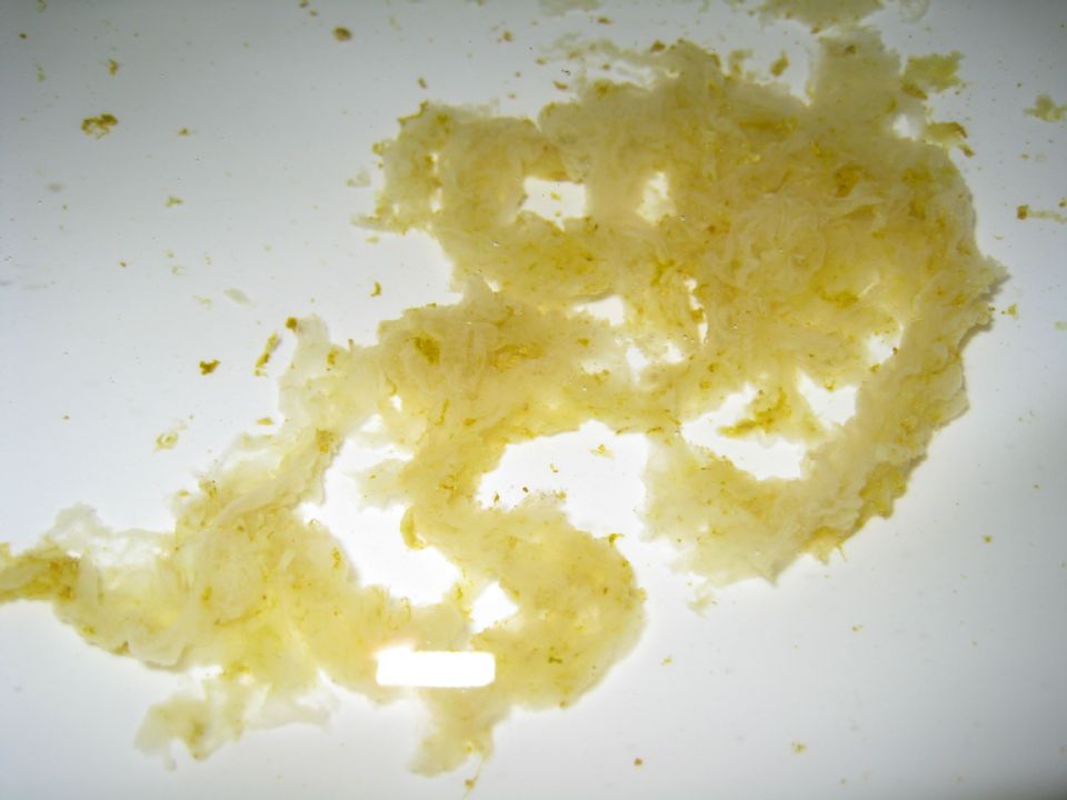 This white material was flushed out of a person after they used an apple cider vinegar enema. This material, pictured here, is likely Candida. Also note that strong concentrations of vinegar can cause skin irritation and chemical burns; using it as an enema may be a poor idea.